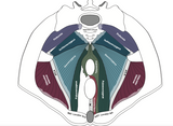 Female Pelvic Floor Model - Levator Avulsion (gloss coated board)