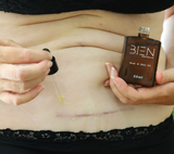 Scar and Skin Bundle (6 x Silicone Scar Strips)