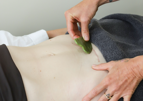 How to improve the appearance of C-Section scars over time
